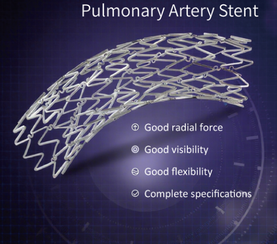 Pulmonary Artery Stent